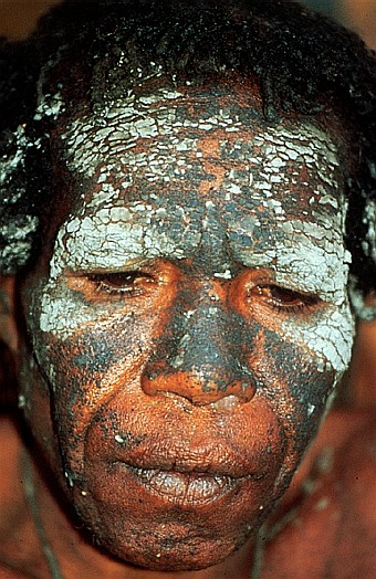Dani tribe, Irian Jaya, Indonesia. Dr. Zoltan Takacs.