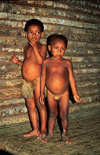 Ningerum tribe, Upper Fly river, Papua New Guinea. Dr. Zoltan Takacs.